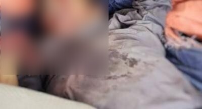 The Razih Child Whose Name and Suffering Were Distorted by the Houthis' Landmine 