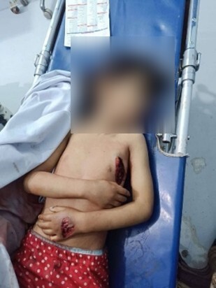 Bayan Al-Humayqani: A Victim of the Houthi Double Killing Machinery: A Bullet and Disinformation 