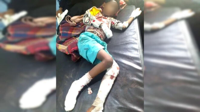 Disinformation Story: Deadly Game — Two Displaced Sisters Wounded by a Landmine, and the Truth Lost Amid Disinformation